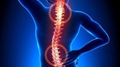 Mechanismus der Osteochondrose-Entwicklung
