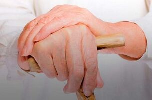 Schmerzen in den Fingergelenken mit rheumatoider Arthritis