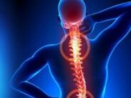 Rückenturnen bei Osteochondrose. 