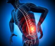 verschiedene Ursachen für Rückenschmerzen