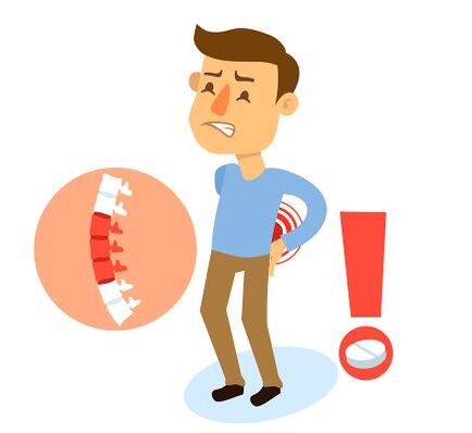 Verschiedene Gründe führen zur Osteochondrose der Wirbelsäule. 