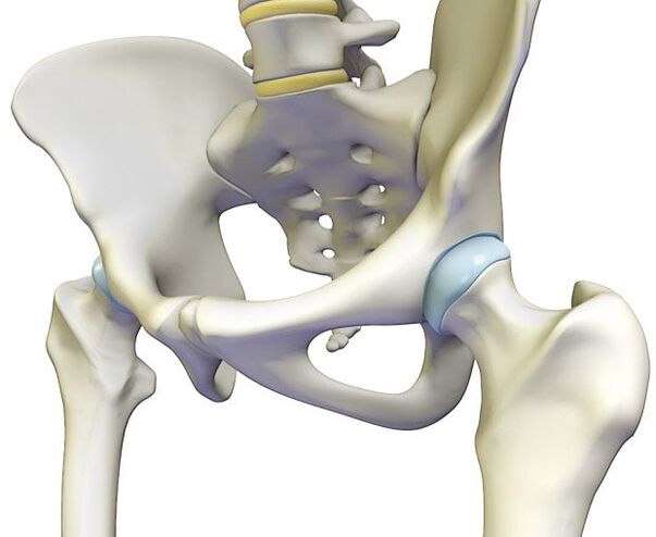 Osteochondrose verursacht akute Schmerzen im Hüftgelenk. 